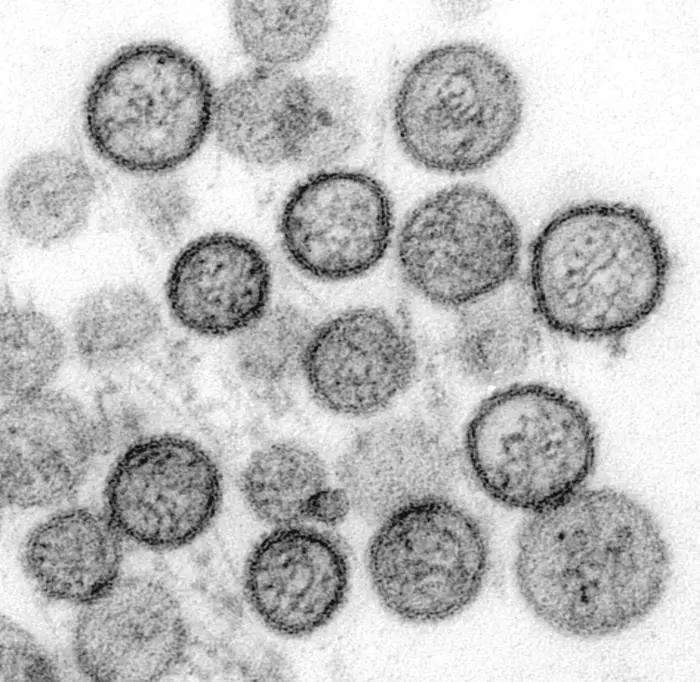 Hantavirus — dezinfekce po hlodavcích DERASPOL s.r.o.© Morava